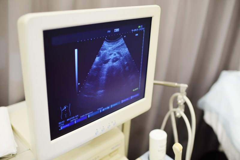 Opowieść o jednym badaniu ultrasonograficznym